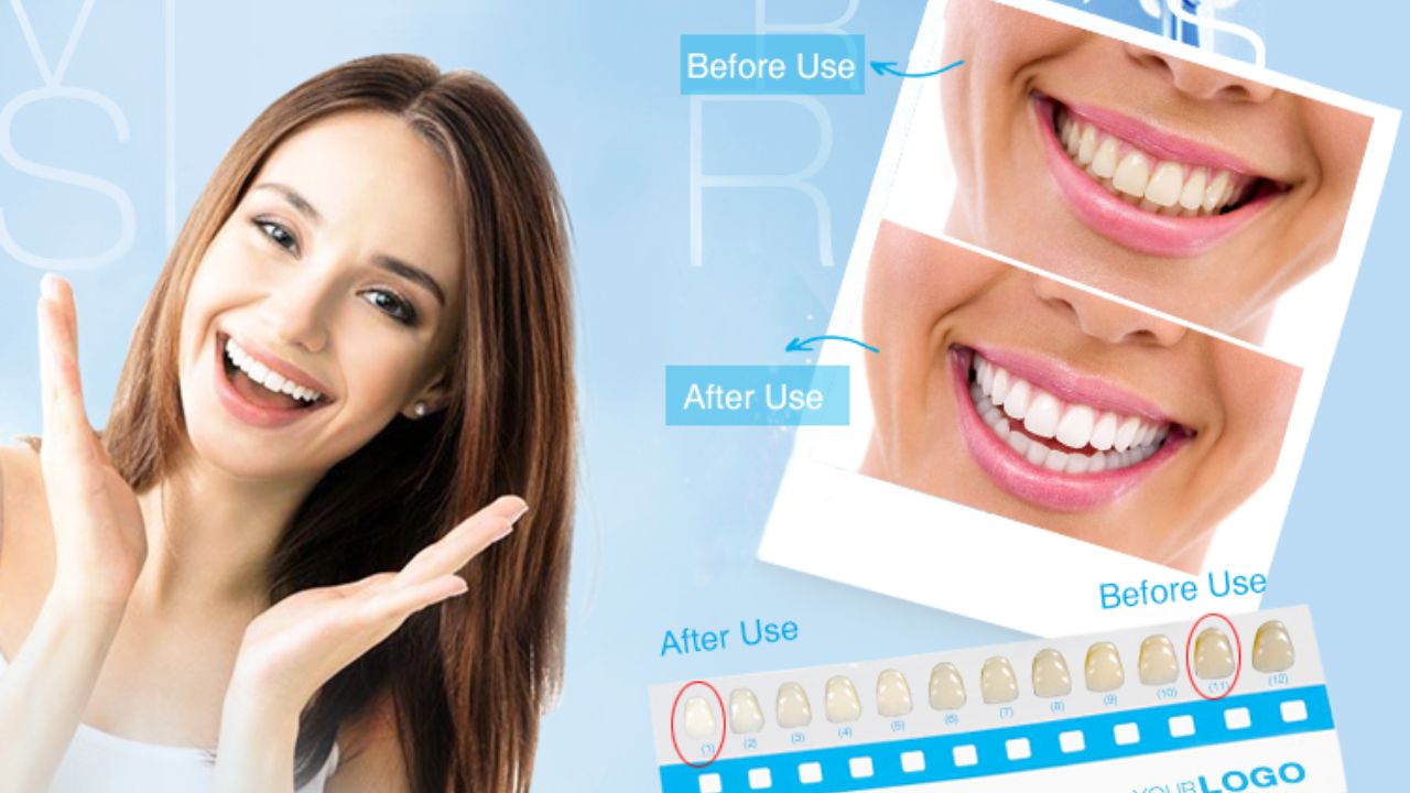 Illuminate Your Smile: Find out the benefits of Teeth Whitening Kits